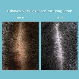 SahaScalp™ - Yabani Zencefil İçeren Arındırıcı Peeling